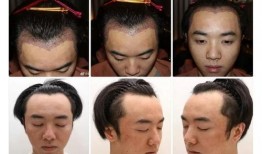 整容爆料大全视频下载免费,整容爆料大全视频免费下载